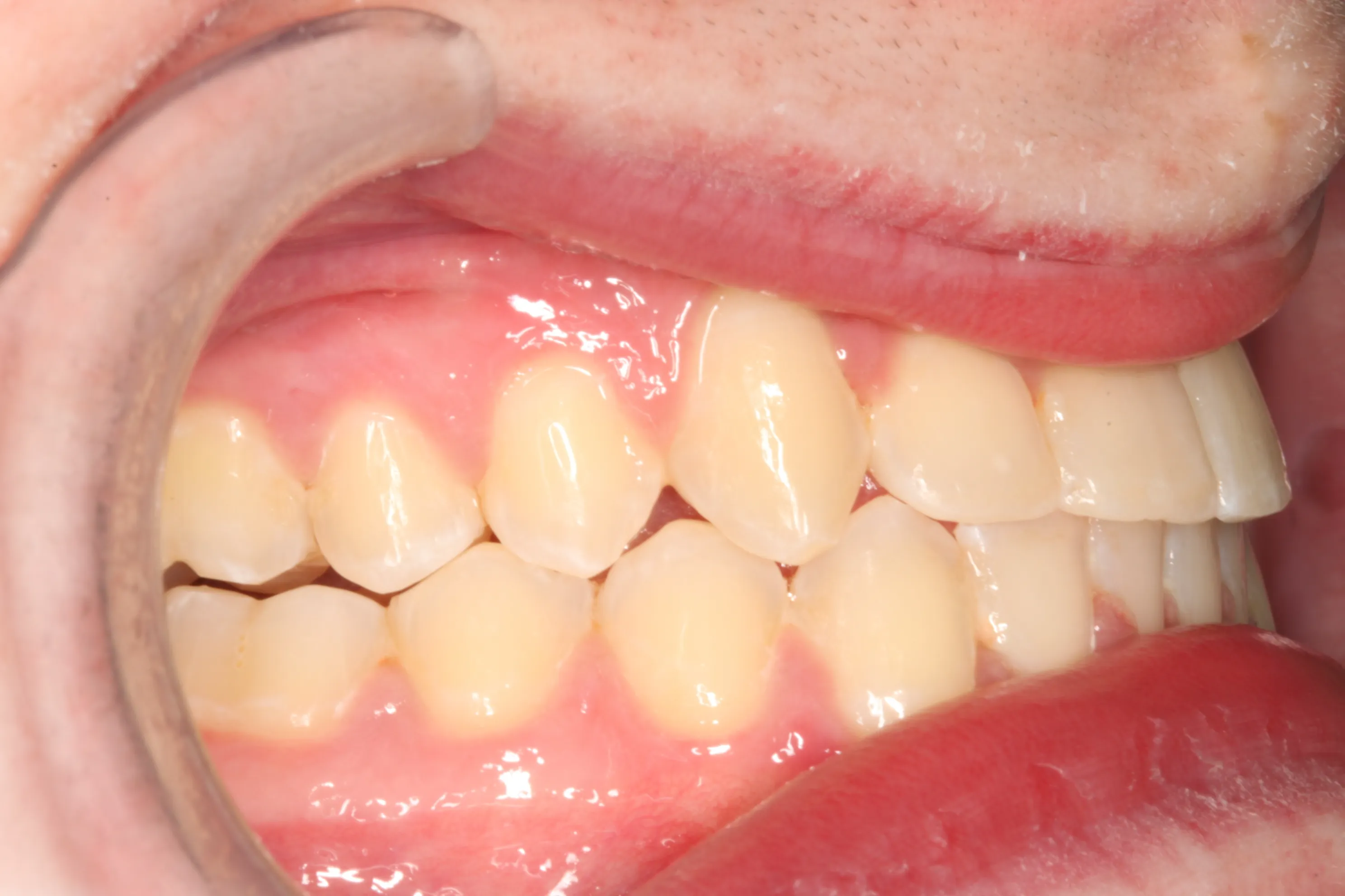 smile-gallery gallery